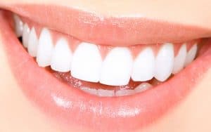 5 dicas para quem faz clareamento dental