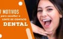 7 motivos para escolher a lente de contato dental - Royal Odontologia